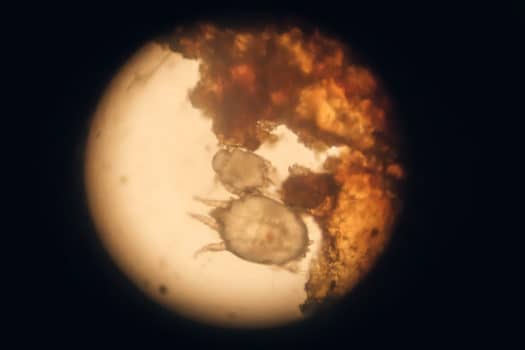 You are currently viewing WHAT IS SCABIES MITES