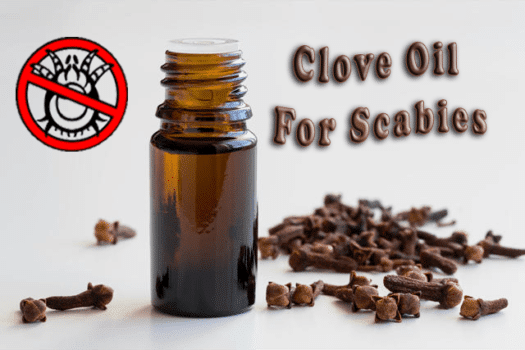 You are currently viewing HOW TO USE CLOVE OIL FOR SCABIES