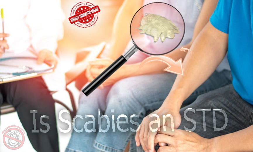 Read more about the article Is scabies always an STD?